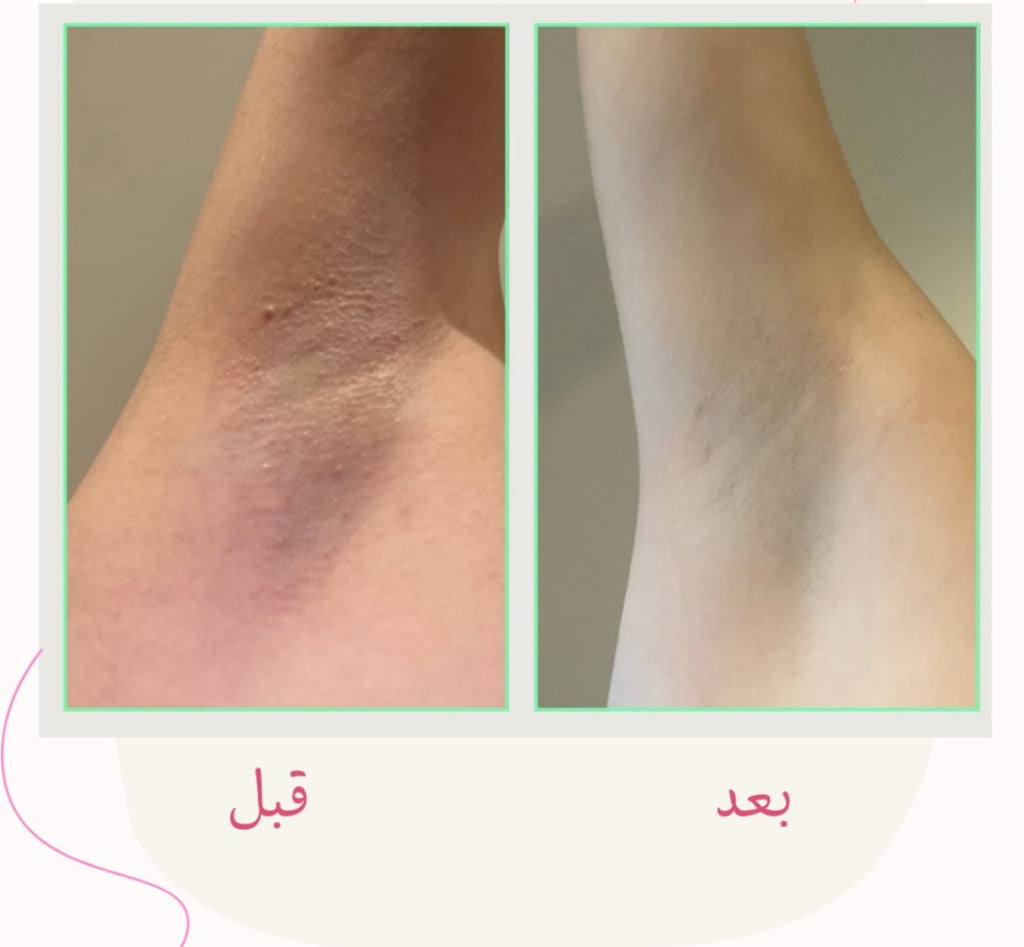 زيت الجسم العلاجي