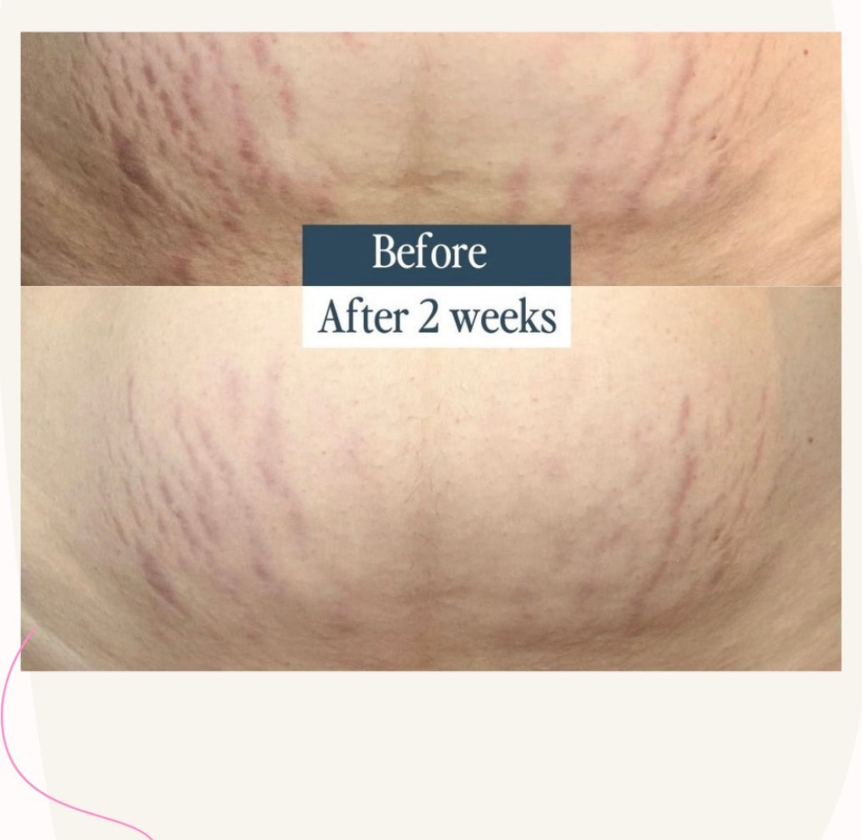 زيت الجسم العلاجي