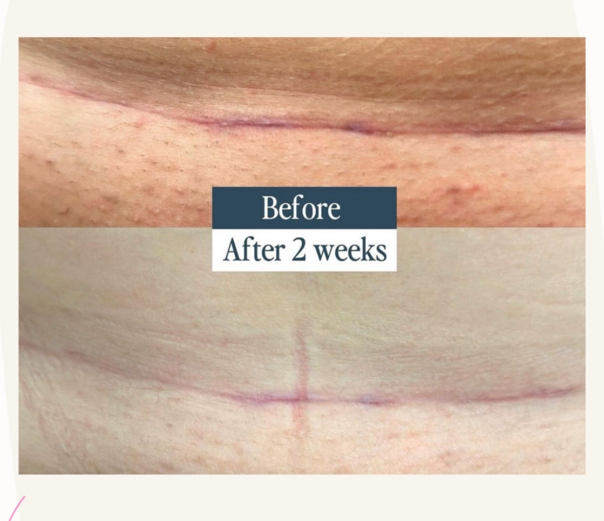 زيت الجسم العلاجي