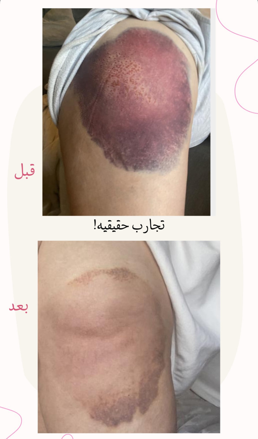 زيت الجسم العلاجي