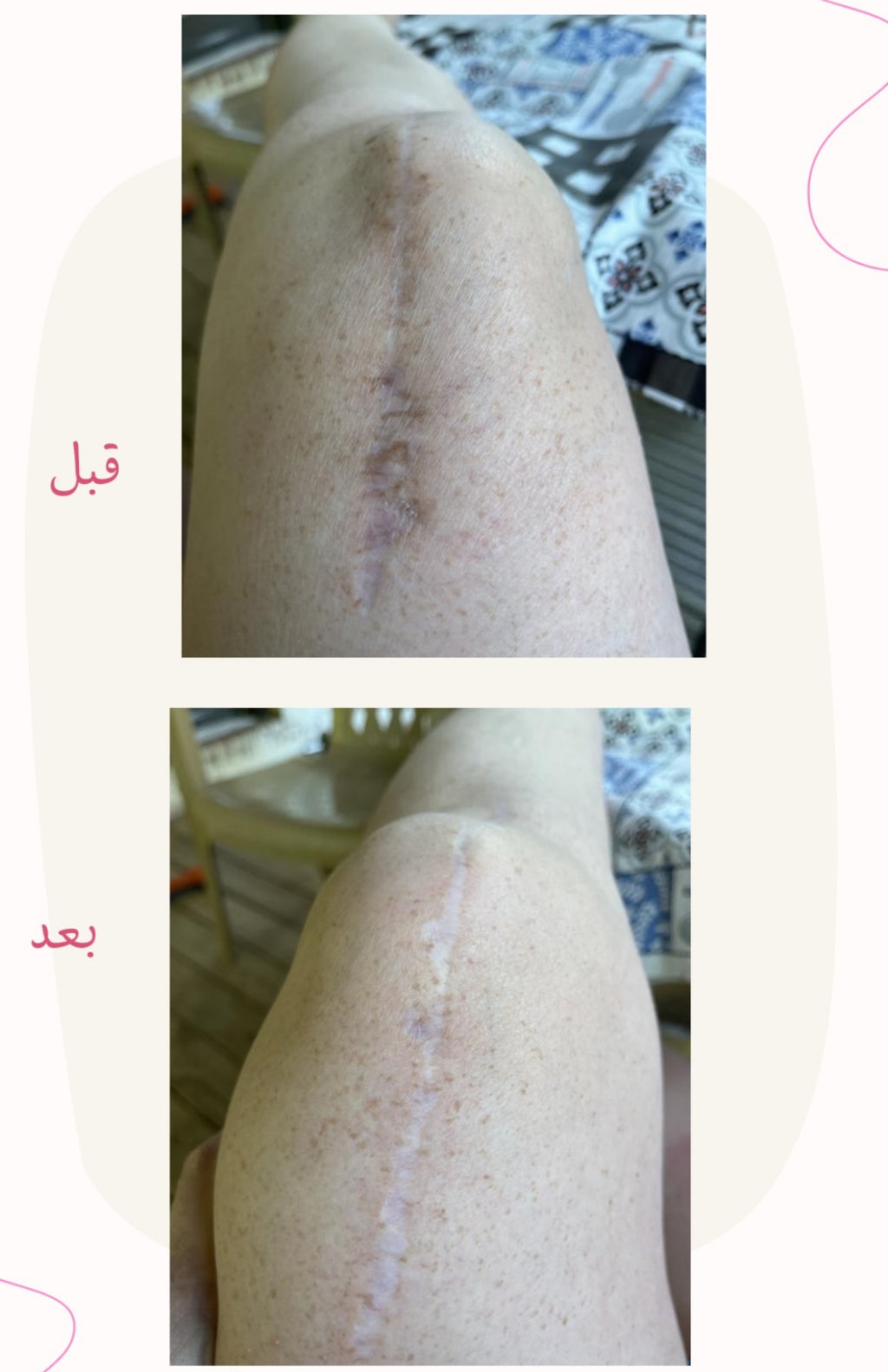 زيت الجسم العلاجي