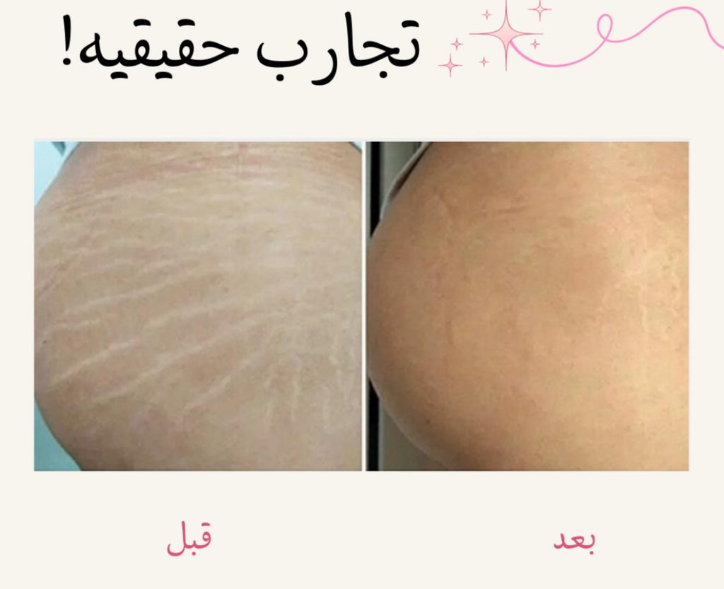 زيت الجسم العلاجي