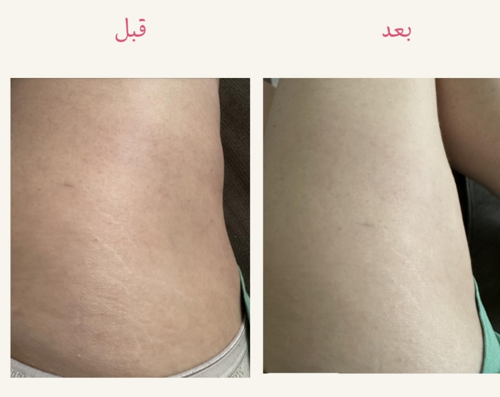 زيت الجسم العلاجي