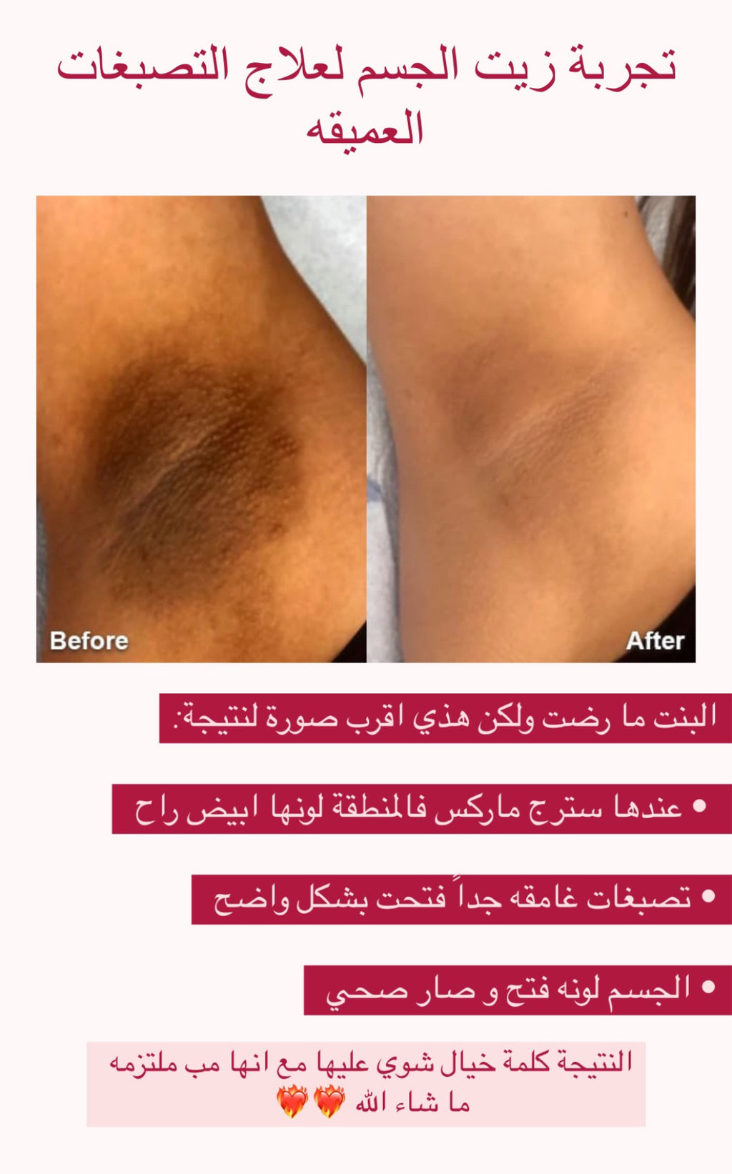 زيت الجسم العلاجي